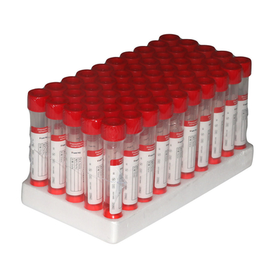 2ml VTM Viral Transport Media Kit Inaktivasi Non Inactivation Sampling